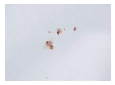 bed bug blood on sheets